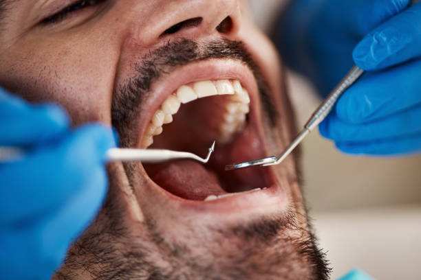 Best Urgent Tooth Repair  in Tilden, NE