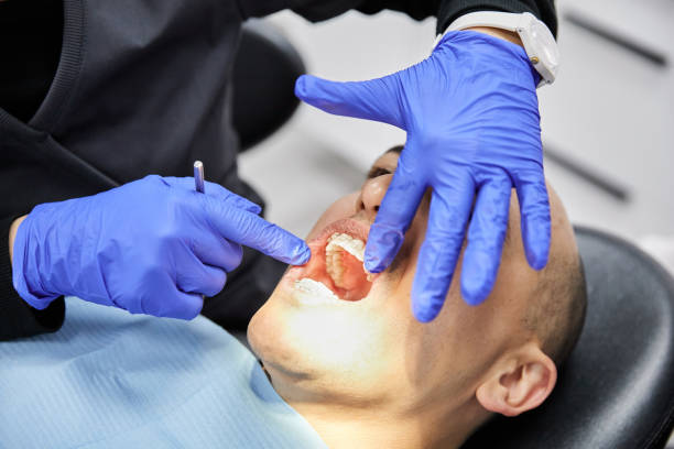 Best Urgent Tooth Repair  in Tilden, NE